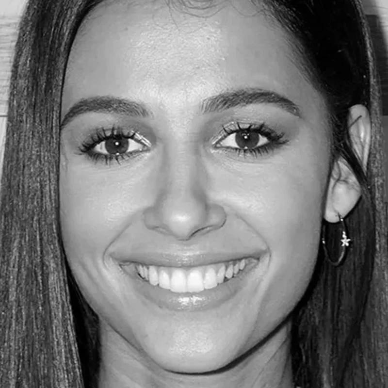 Balanced Shape Cheekbones