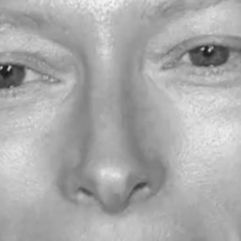 Sharp Prominent Nose